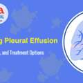 Understanding Pleural Effusion Symptoms, Diagnosis & Treatment