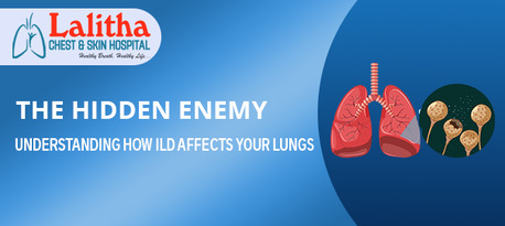 Karimnagar, Health, Understanding The Impact Of Interstitial Lung Diseases