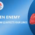 Understanding The Impact Of Interstitial Lung Diseases