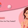 Blistering Skin Diseases: Causes, Symptoms, And Treatments