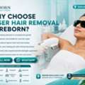 Laser Hair Removal Near Banjara Hills| Smooth, Hair-Free Skin At Reborn Skin And Hair Cli
