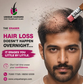 Chennai, Health, Hair Transplant Cost In Chennai