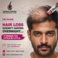 Hair Transplant Cost In Chennai