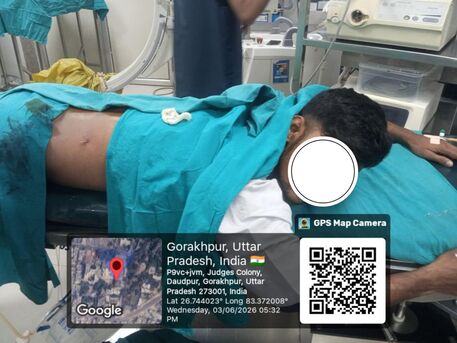 Lucknow, Health, Patient Recovers After Successful Kidney Stone Surgery In Gorakhpur