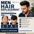 Non Surgical Hair Replacement For Men In Fresno, CA.