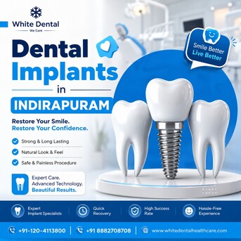 Ghaziabad, Dental, Dental Implants In Indirapuram For Permanent Tooth Replacement
