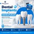 Dental Implants In Indirapuram For Permanent Tooth Replacement
