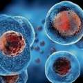 Advanced Stem Cell Therapy In India | Global Stem Cell Care