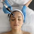Microneedling Near Chino Hills | Smooth, Radiant Skin