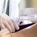 Balgowlah Skin Cancer Clinic: Early Detection For Better Health