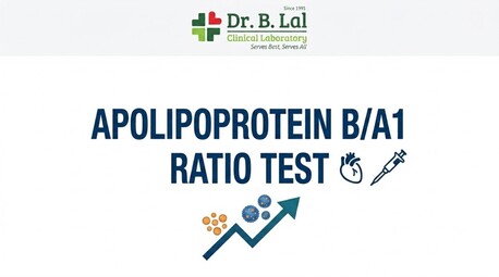 Jaipur, Health & Beauty Items, INR 1375,  Apolipoprotein ApoB/ApoA1 Ratio For Cardiovascular Risk Stratification