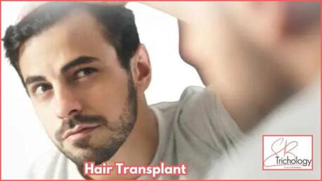 Gurgaon, Health, Best Clinic For Hair Transplant In Gurgaon - SB Trichology