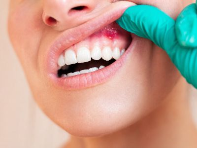 Kolkata, General, Expert Dental Services At AB Dentologic Newtown
