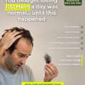 Hair Specialist In Hyderabad &ndash; Stop Hair Fall Before It Becomes A Bigger Problem