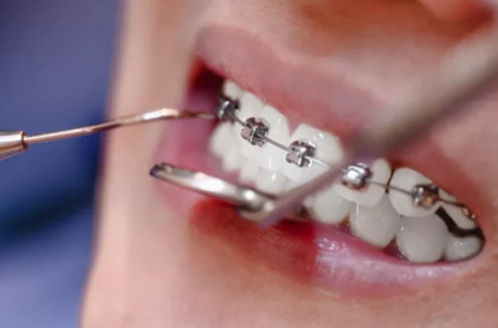 New York, Dental, Teeth Extractions In Rosedale, MD | Gentle & Affordable Dental Care