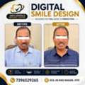 Digital Smile Design Before And After | Smile Dental & Implant Centre