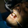 Teeth Removal And Dental Implants &ndash; Restore Your Healthy Smile