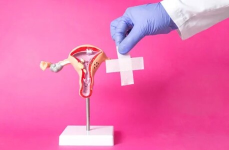 Mumbai, Health, Hysteroscopy Polypectomy For Infertility Treatment In Bareilly