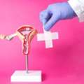 Hysteroscopy Polypectomy For Infertility Treatment In Bareilly