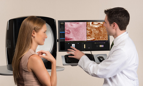 Toronto, Beautician, Exion AI RF Microneedling In Richmond Hill
