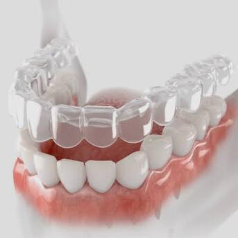 Singapore, Dental, The Invisible Shield: Unveiling The Magic Of Clear Retainers