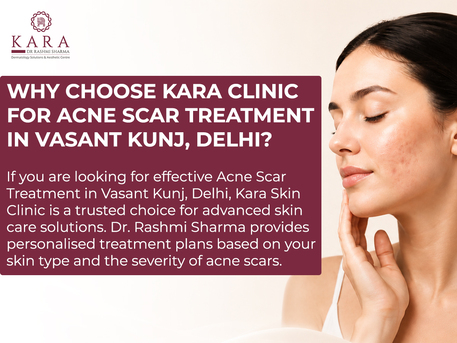 New Delhi, Health, Advanced Acne Scar Treatment In Vasant Kunj For Smooth Skin Texture