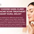 Advanced Acne Scar Treatment In Vasant Kunj For Smooth Skin Texture