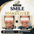 Get Your Dream Smile! Custom Smile Makeovers At Smile Dental & Implant Centre