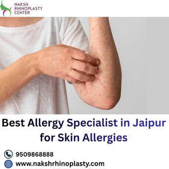 Jaipur, Health, Best Allergy Specialist In Jaipur For Skin Allergies