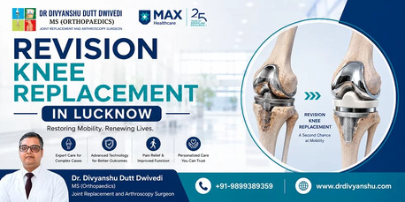 Lucknow, Medical, Experienced Revision Knee Replacement Surgeon In Lucknow