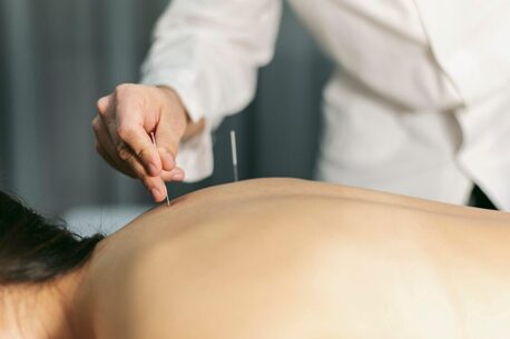 New York, Health, Experienced Acupuncturist In Tucson AZ