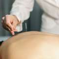 Experienced Acupuncturist In Tucson AZ