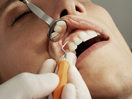 Mumbai, Dental, Affordable Dentist Near Me | Low-Cost Dental Clinic In Gorakhpur