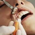 Affordable Dentist Near Me | Low-Cost Dental Clinic In Gorakhpur
