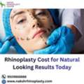 Rhinoplasty Cost For Natural Looking Results Today