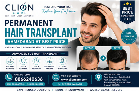 Ahmedabad, Health, Expert Hair Transplant & Restoration Clinic Ahmedabad