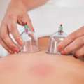 Professional Cupping Therapy In Folsom For Lasting Relief