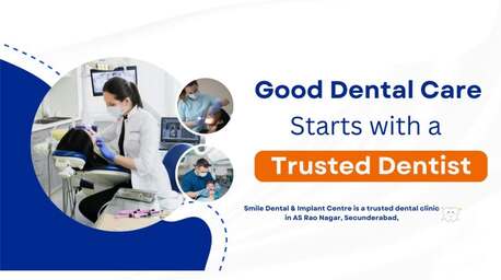 Hyderabad, Dental, Experience Painless Dentistry At AS Rao Nagar