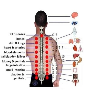 Riyadh, Beautician, Hijama (Cupping Therapy)