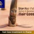 Advanced Hair Loss Treatment In Thane | DNA Royal Clinic.