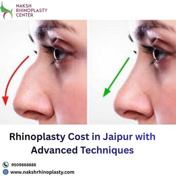 Jaipur, Health, Rhinoplasty Cost In Jaipur With Advanced Techniques
