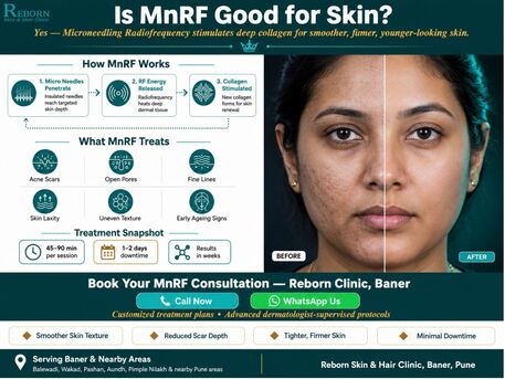 Pune, Health, MnRF Treatment Near Aundh In Baner