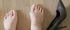 Singapore, Health, Benefits Of Treating Bunions On Feet