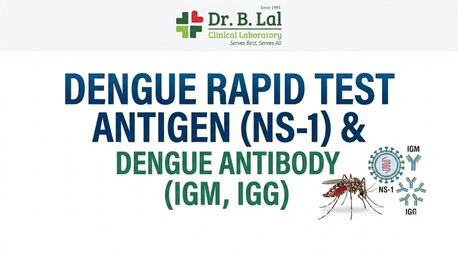 Jaipur, Health & Beauty Items, INR 1200,  Doctor-Recommended Dengue Test In Jaipur | NS1, IgM & IgG