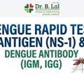 INR 1200,  Doctor-Recommended Dengue Test In Jaipur | NS1, IgM & IgG