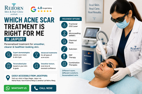 Jaipur, Health & Beauty Items, INR 2500,  Best Acne Scar Treatment In Jaipur &ndash; Find The Right Solution