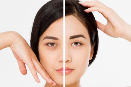Noida, Health, Dark Circles Treatment In Noida &ndash; Look Fresh And Well-Rested Again