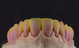 Beijing, Dental, Dental Laboratory In China