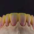 Dental Laboratory In China