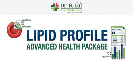 Jaipur, Health & Beauty Items, INR 500,  Lipid Profile Test In Jodhpur | Affordable Heart Health Check At ₹500